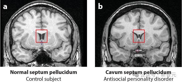 Anthropic CEO详述未来:26年内强大AI将诞生,智能超越诺奖得主 Anthropic CEO详述未来:26年内强大AI将诞生,智能超越诺奖得主